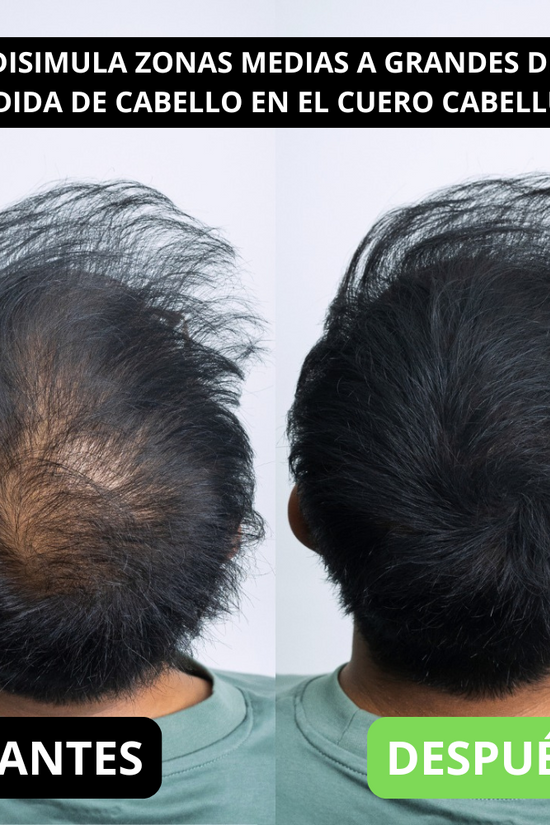 Renee cover up Hair Volume Powder for Men & women