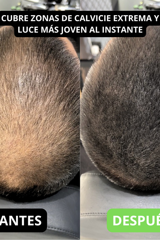 Renee cover up Hair Volume Powder for Men & women