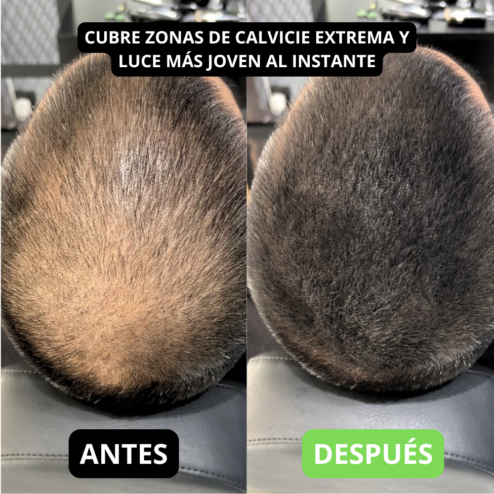 Renee cover up Hair Volume Powder for Men & women