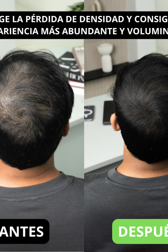 Renee cover up Hair Volume Powder for Men & women
