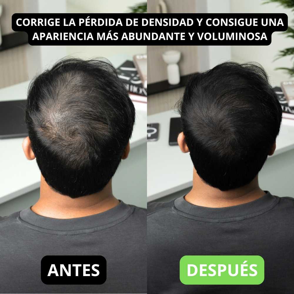 Renee cover up Hair Volume Powder for Men & women