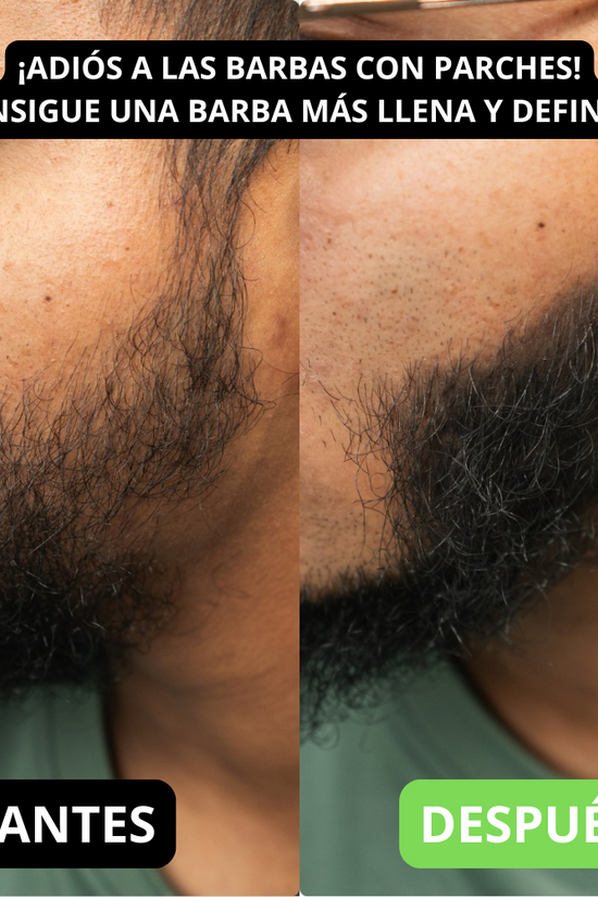 Renee cover up Hair Volume Powder for Men & women