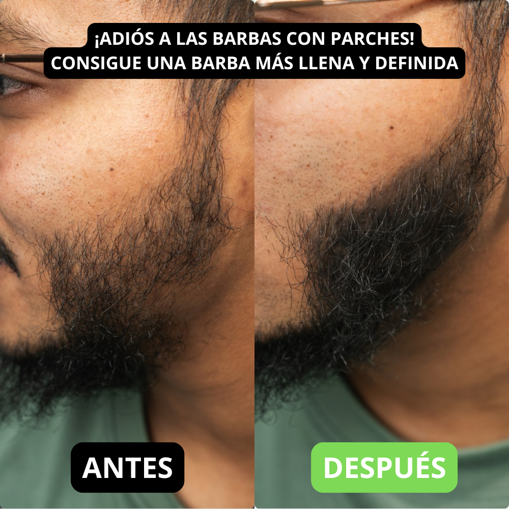 Renee cover up Hair Volume Powder for Men & women