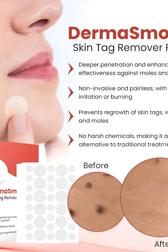 Skin Tag Remover Patch  (72 Patches)