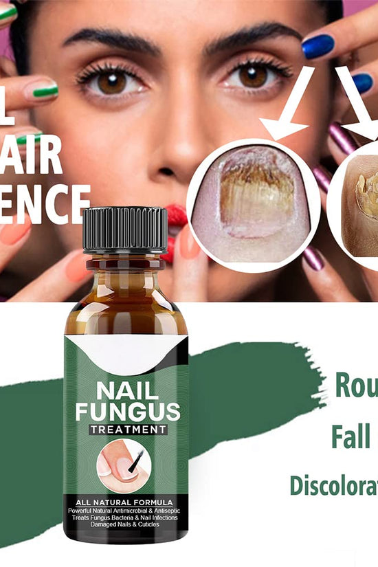 Nail Fungus Treatment Oil (Imported)