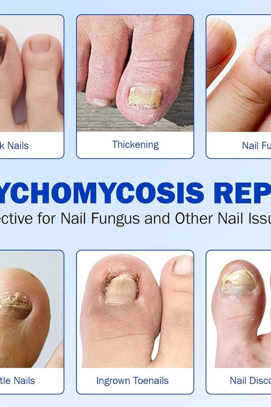 Nighttime Renewal Fungal Nail Patches (Pack of 21)