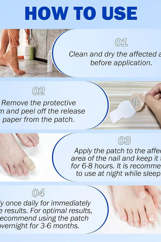 Nighttime Renewal Fungal Nail Patches (Pack of 21)