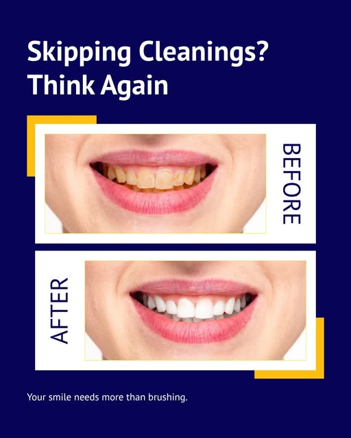 2 in 1 Tooth brush & tongue cleaner