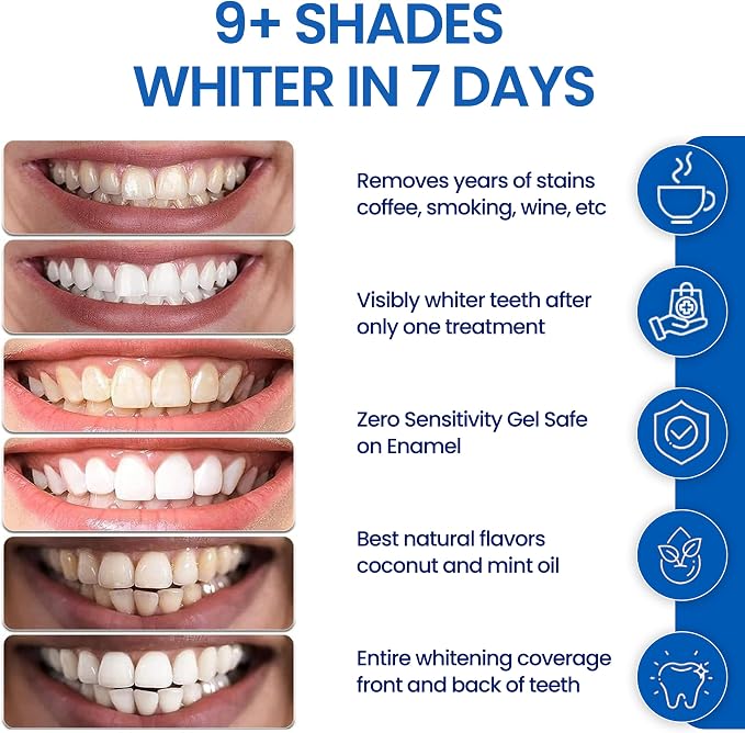 Teeth Whitening Strips (Pack of 10) IMPORTED