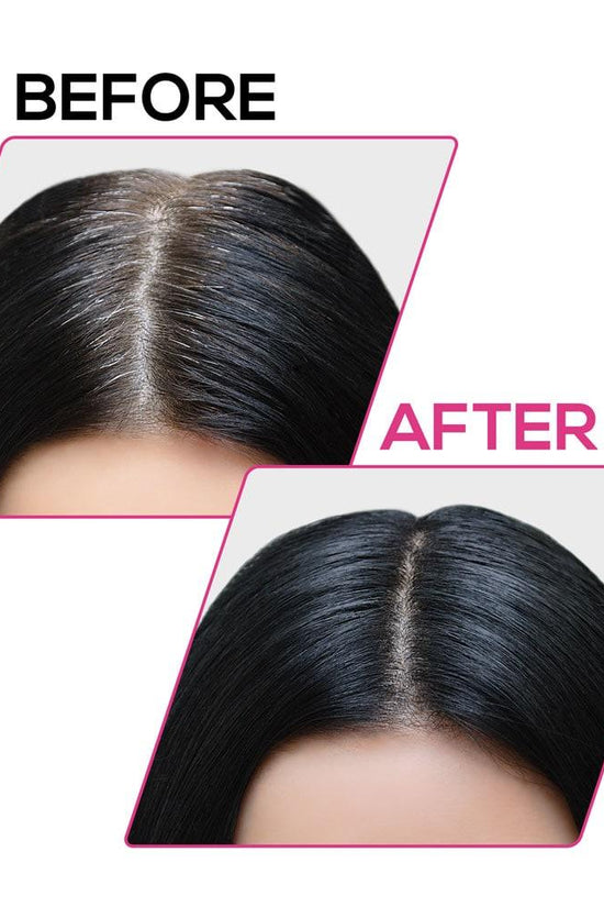 Renee cover up Hair Volume Powder for Men & women