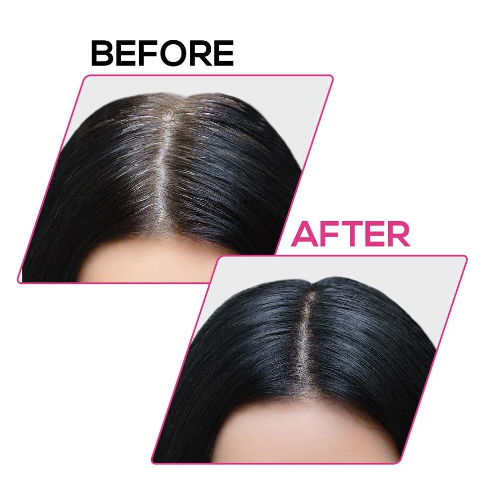 Renee cover up Hair Volume Powder for Men & women