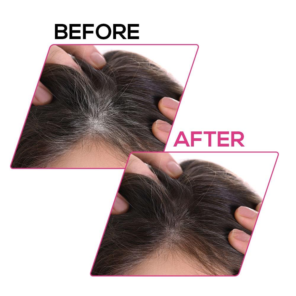 Renee cover up Hair Volume Powder for Men & women
