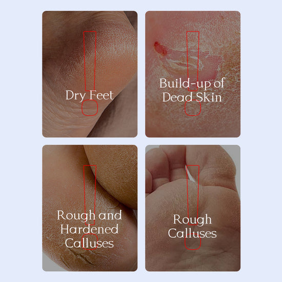Foot Peel Mask
