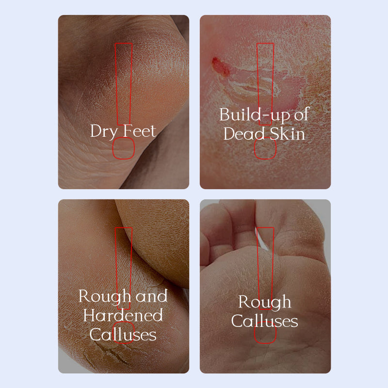 Foot Peel Mask