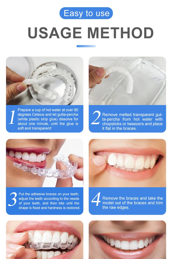Snap-on Smile teeth