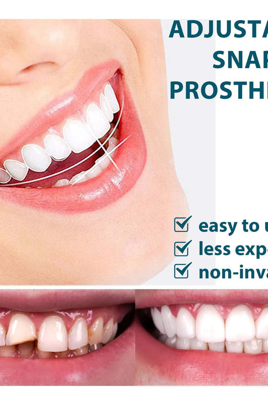 Snap-on Smile teeth