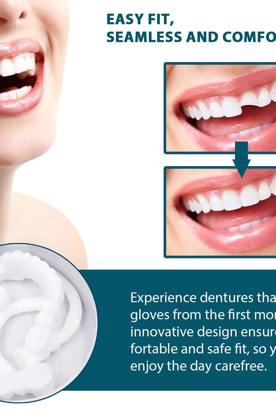 Snap-on Smile teeth