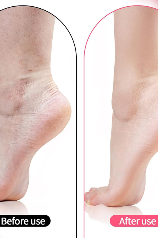 Premium Silicone Moisturizing Gel Socks – Reusable Heel Repair & Dry Foot Treatment