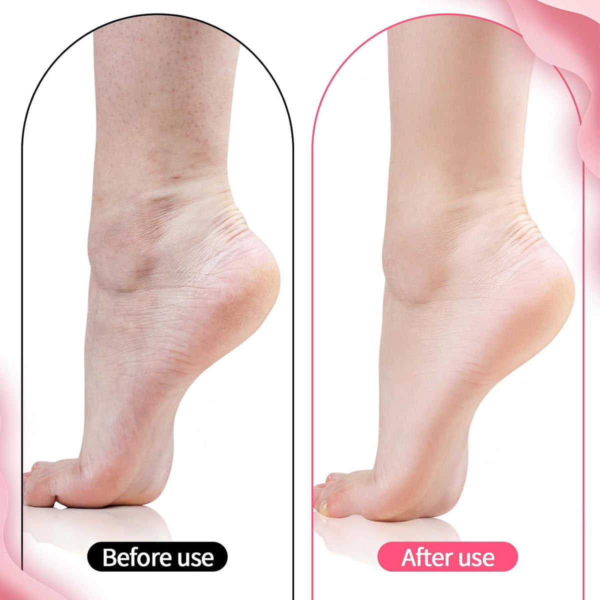 Premium Silicone Moisturizing Gel Socks – Reusable Heel Repair & Dry Foot Treatment